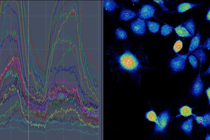 Estrogen-Induced Calcium Flux in Astrocytes_0